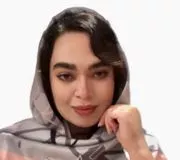 تصویر پروفایل دکتر الناز خانبان زاده - دکترای حرفه‌ای پزشکی