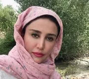 تصویر پروفایل دکتر نفیسه جوادیان - دکترای حرفه‌ای دندانپزشکی در اصفهان