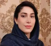 تصویر پروفایل دکتر یلدا رستمی - دکترای حرفه‌ای دندانپزشکی در تهران