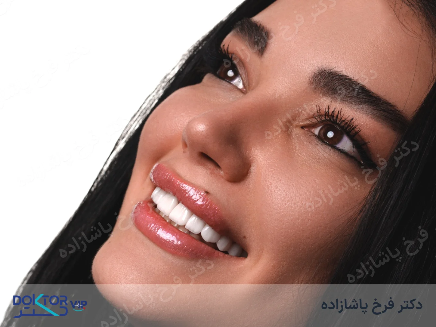 بعد از درمان