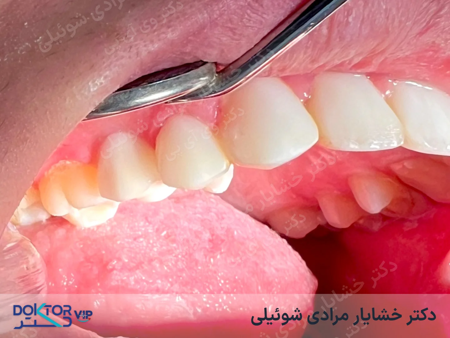 بعد