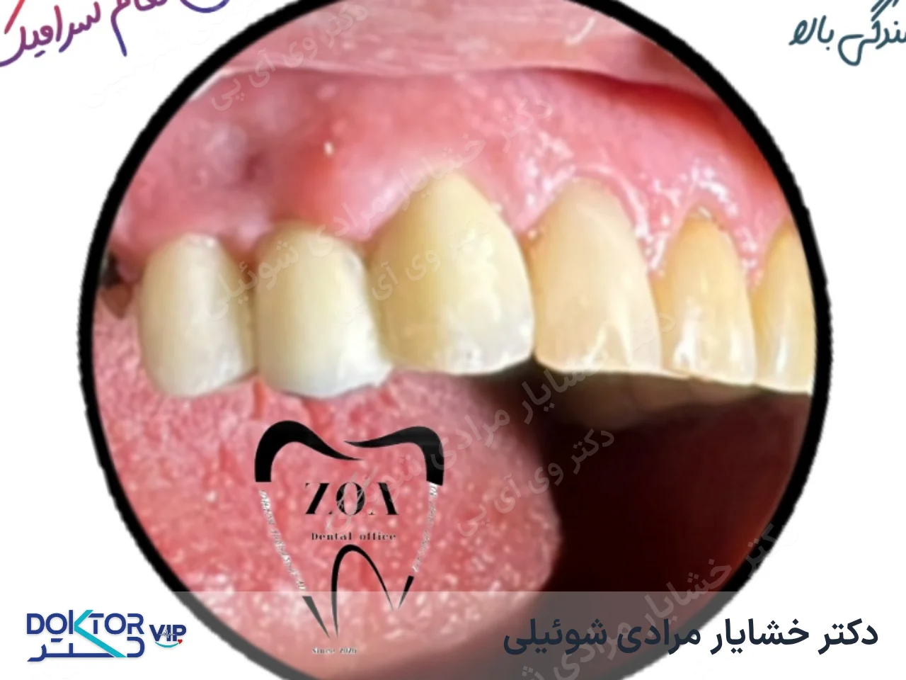 بعد