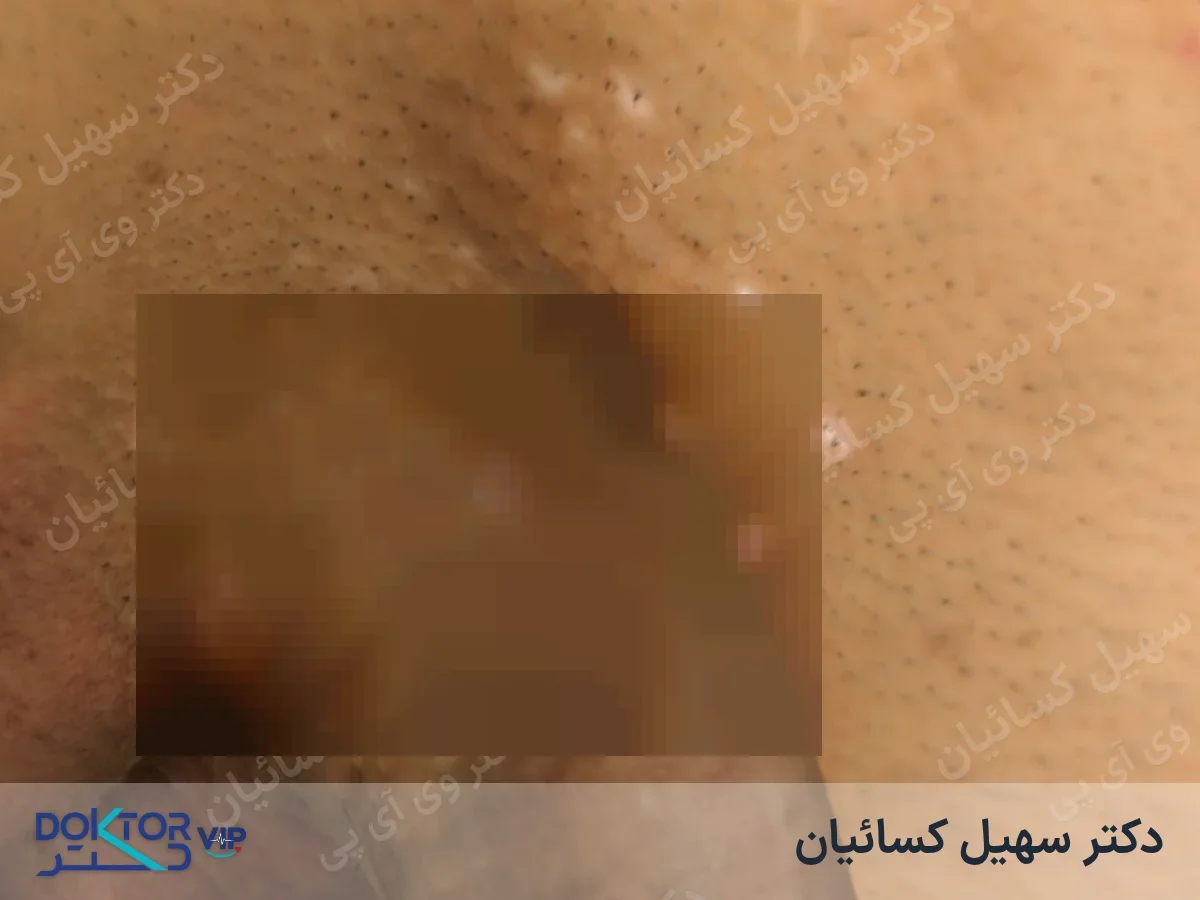 بعد از درمان