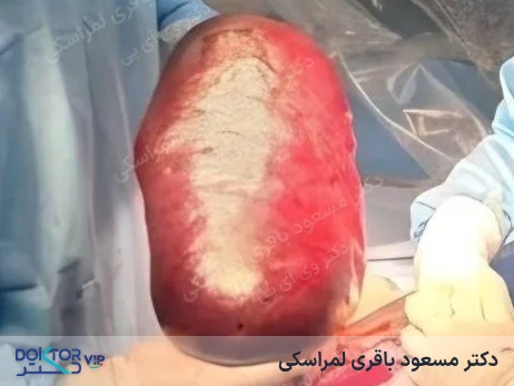 بعد از درمان